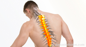 Groton thoracic spine pain image 