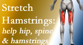 Shoreline Medical Services/ Hutter Chiropractic Office promotes back pain patients to stretch hamstrings for length, range of motion and flexibility to support the spine.