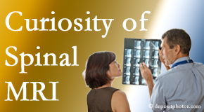 Groton MRIs for spinal stenosis may be revealing…or confusing.