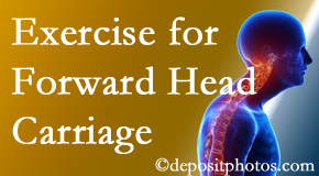 Groton chiropractic treatment of forward head carriage is two-fold: manipulation and exercise.
