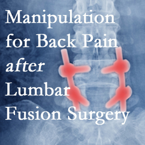 Groton chiropractic spinal manipulation helps post-surgical continued back pain patients discover relief of their pain despite fusion. 