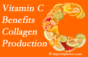 Groton chiropractic offers tips on nutrition like vitamin C for boosting collagen production that decreases in musculoskeletal conditions.