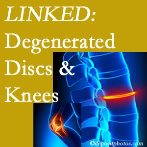 Degenerated discs and degenerated knees are not such strange bedfellows. They are seen to be related. Groton patients with a loss of disc height due to disc degeneration often also have knee pain related to degeneration.  