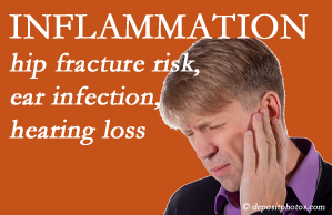 Shoreline Medical Services/ Hutter Chiropractic Office recognizes inflammation’s role in pain and shares how it may be a link between otitis media ear infection and increased hip fracture risk. Interesting research!