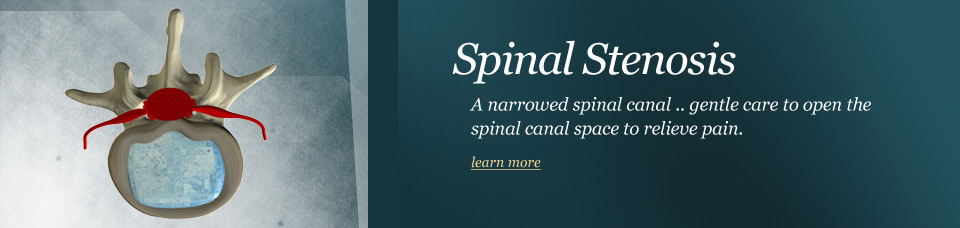 header-spinal-stenosis.jpg
