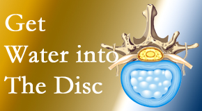 Shoreline Medical Services/ Hutter Chiropractic Office uses spinal manipulation and exercise to enhance the diffusion of water into the disc which helps the health of the disc.