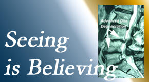 Shoreline Medical Services/ Hutter Chiropractic Office understands how “seeing [imaging – xray or MRI] is believing” works for back pain patients to see the cause of their pain. 