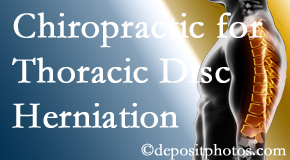 Shoreline Medical Services/ Hutter Chiropractic Office diagnoses and manages thoracic disc herniation pain and relieves its symptoms like unexplained abdominal pain or other gastrointestinal issues. 