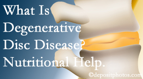 Shoreline Medical Services/ Hutter Chiropractic Office takes care of degenerative disc disease with chiropractic treatment and nutritional interventions. 