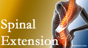 Shoreline Medical Services/ Hutter Chiropractic Office understands the role of extension in spinal motion, its necessity, its benefits and potential harmful effects. 