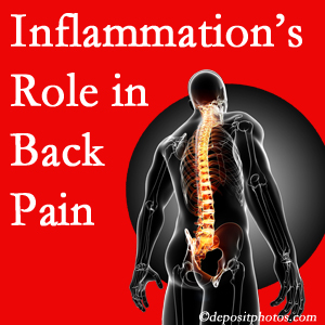 The role of inflammation in Groton back pain is real. Chiropractic care can help.