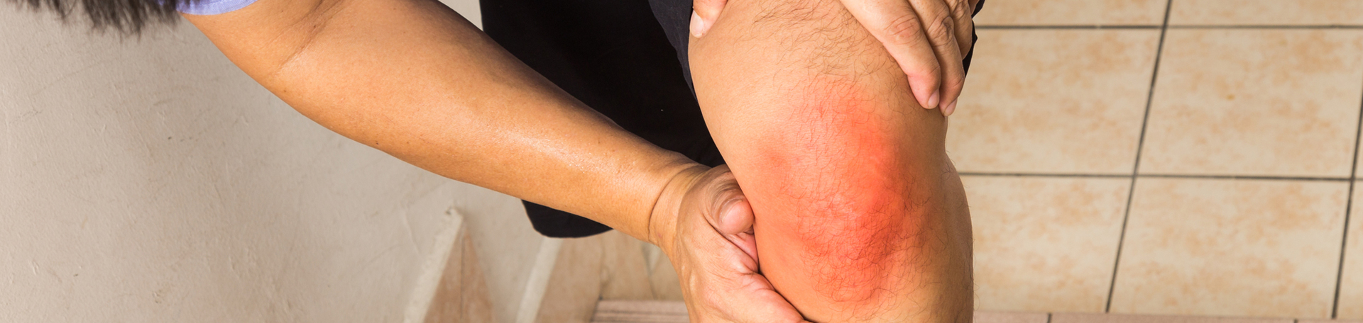 Groton knee pain, osteoarthritis