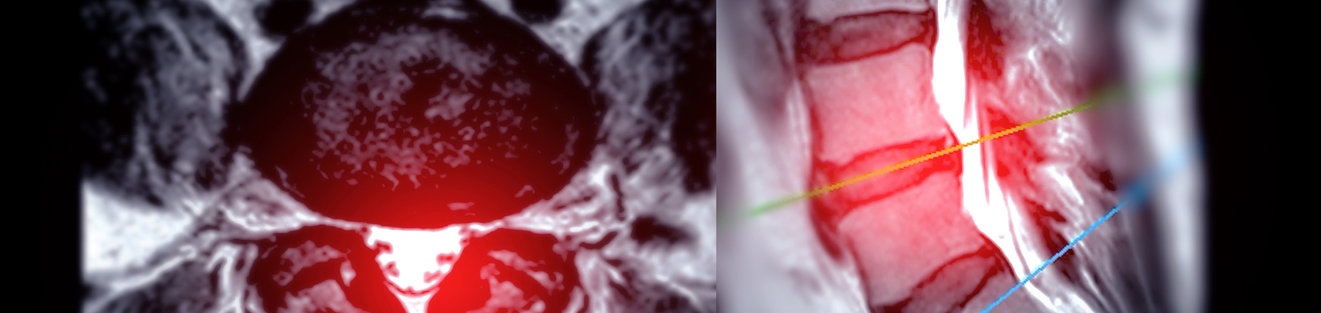 Groton back pain imaging and exercise