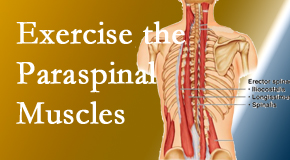 Shoreline Medical Services/ Hutter Chiropractic Office describes the importance of paraspinal muscles and their strength for Groton back pain relief.