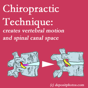 picture of a Groton spinal stenotic canal