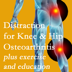 A chiropractic treatment plan for Groton knee pain and hip pain caused by osteoarthritis: education, exercise, distraction.