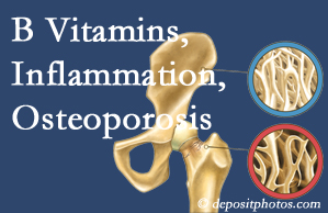 Groton chiropractic care of osteoporosis often comes with nutritional tips like b vitamins for inflammation reduction and for prevention.