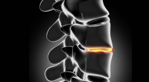 Groton chiropractic nutrition with vitamin D and quercitrin