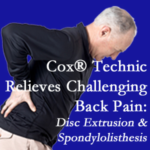 Groton chiropractic care with Cox Technic relieves back pain due to a painful combination of a disc extrusion and a spondylolytic spondylolisthesis.
