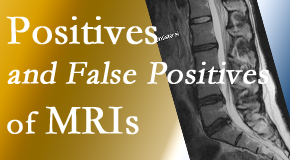 Shoreline Medical Services/ Hutter Chiropractic Office carefully chooses when and if MRI images are needed to guide the Groton chiropractic treatment plan. 